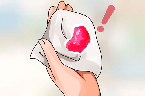 Chảy máu sau quan hệ một tuần: Máu đỏ tươi